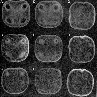 A review on synergy of cavitation and sediment erosion in hydraulic machinery